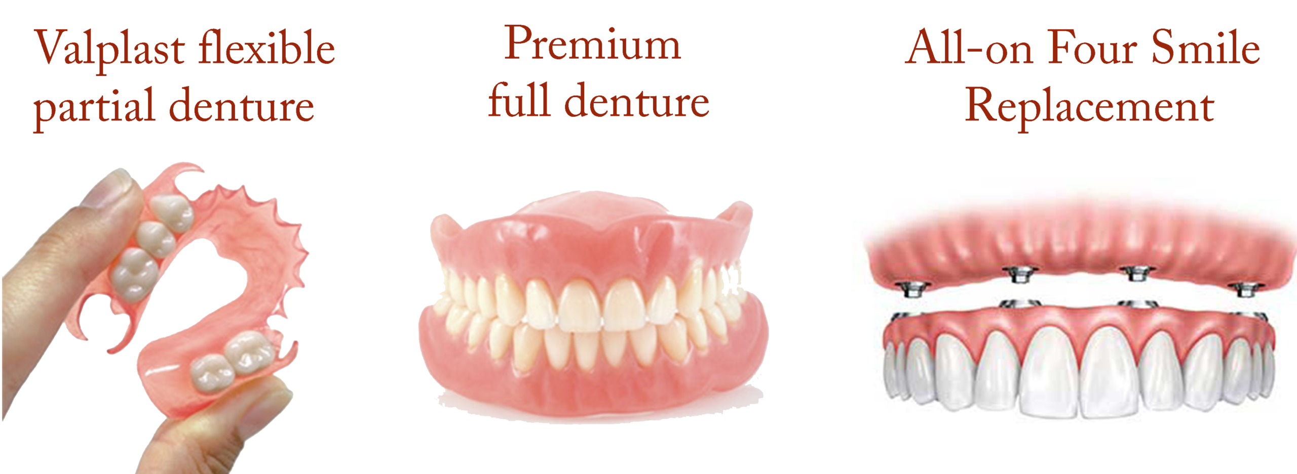 Dentures, Partials, All-On Four